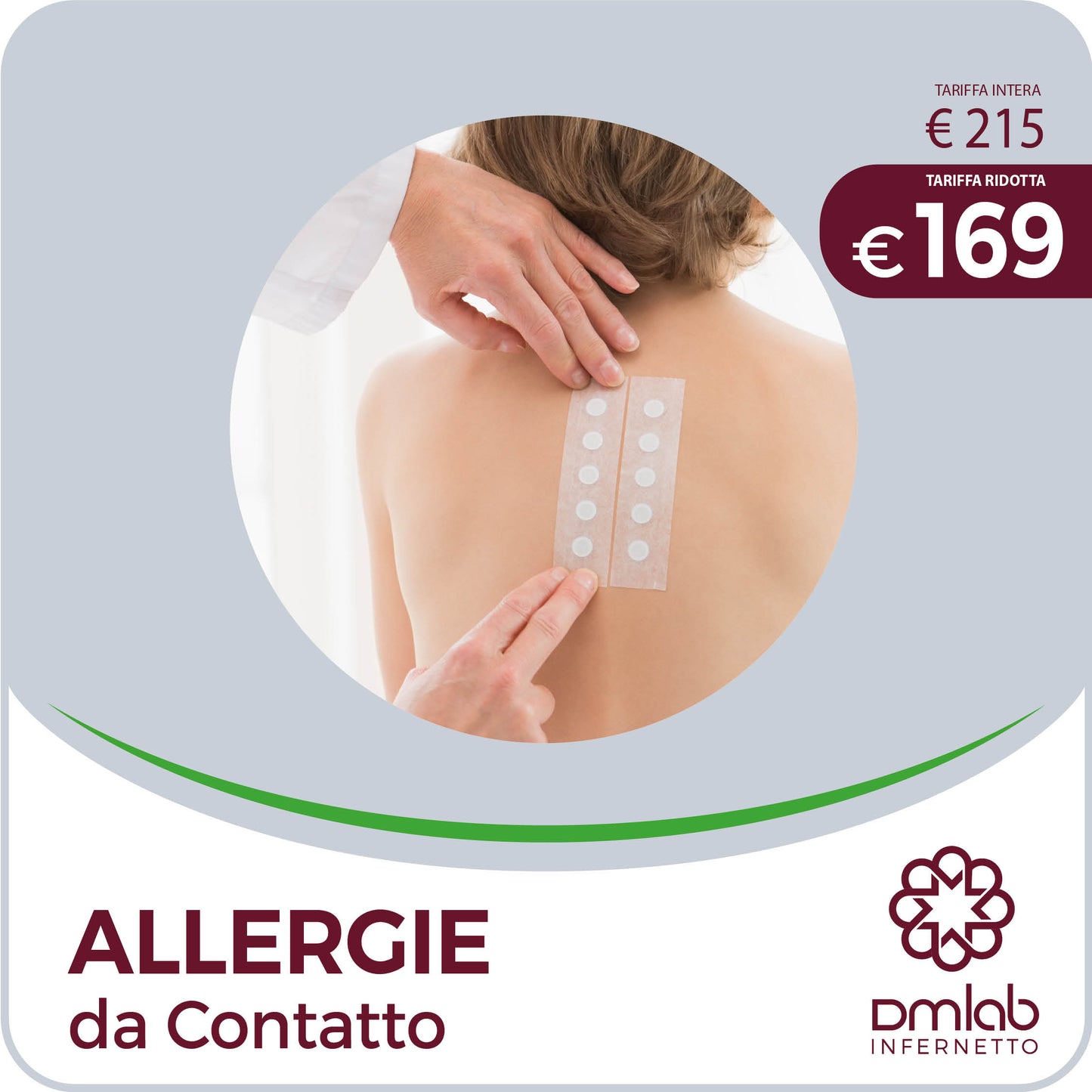 Allergie da Contatto