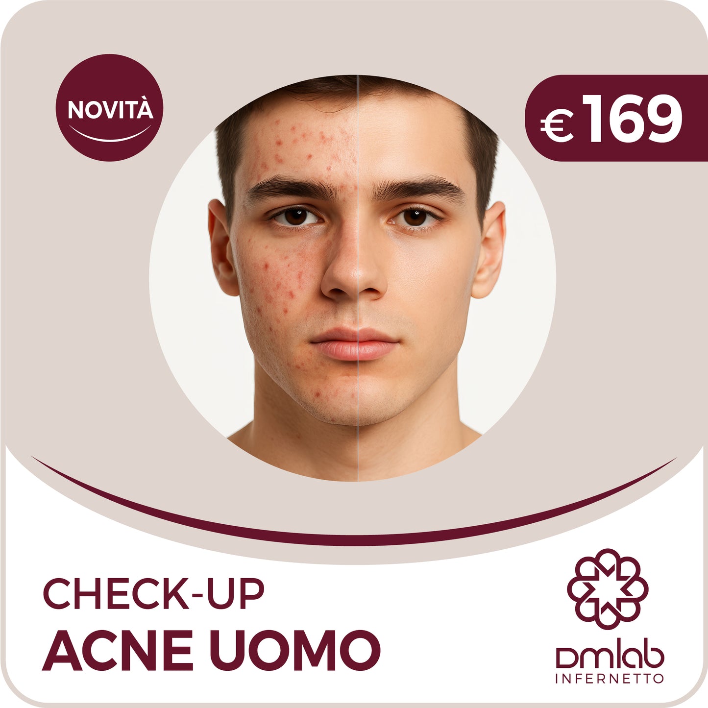 Check-up Acne Uomo