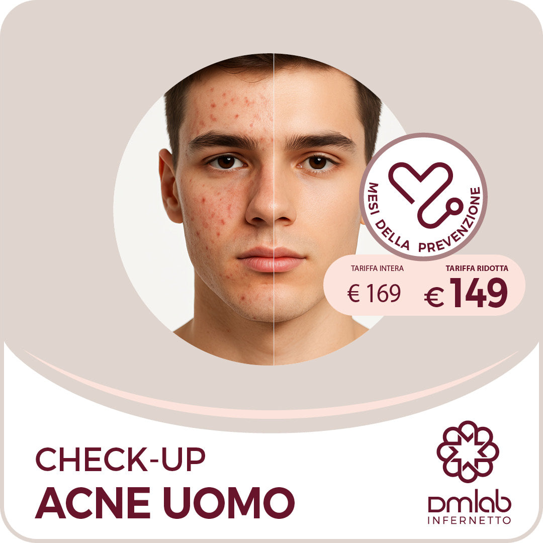 Check-up Acne Uomo