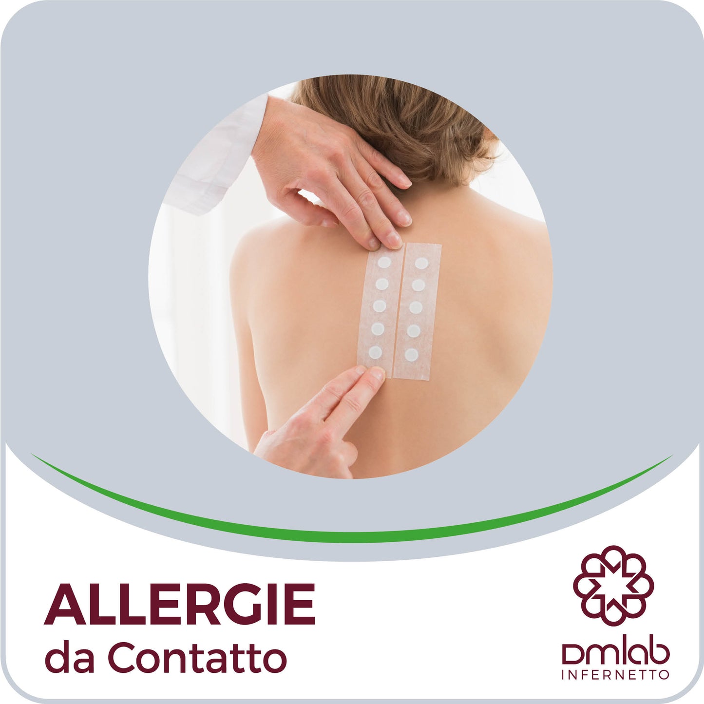 Allergie da Contatto