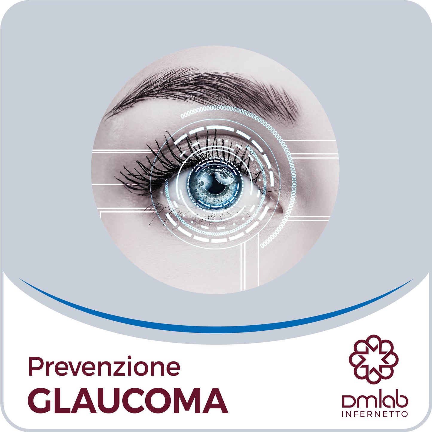 Prevenzione Glaucoma