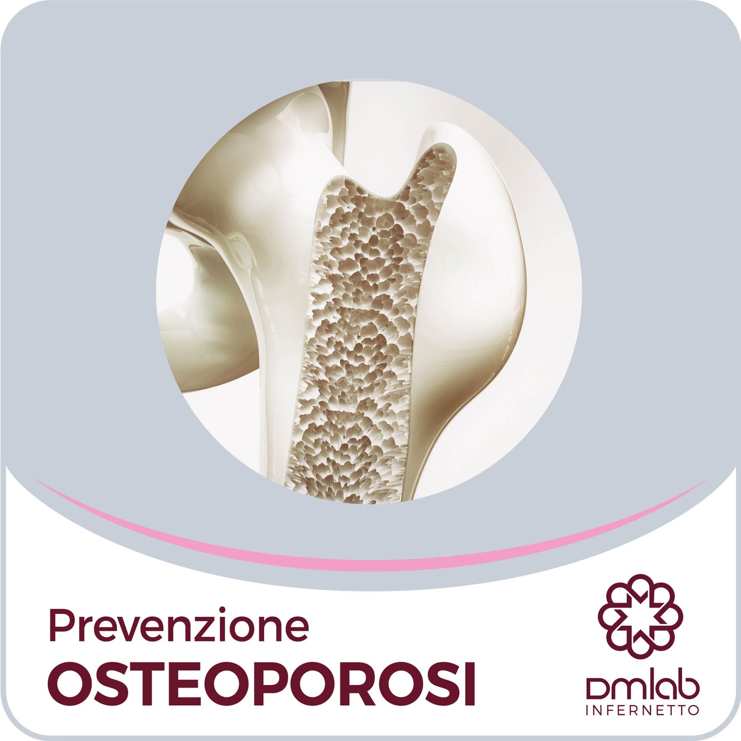Prevenzione Osteoporosi