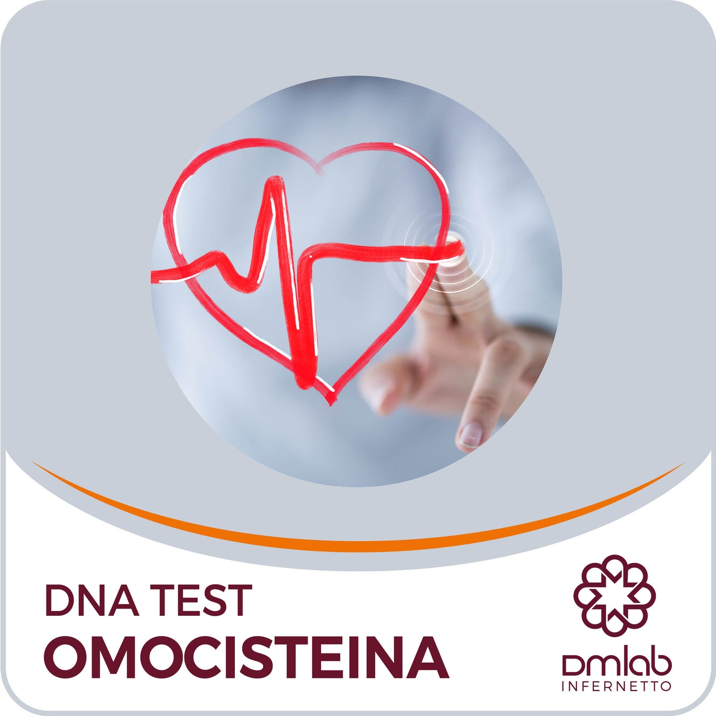 Test Genetico Omocisteina