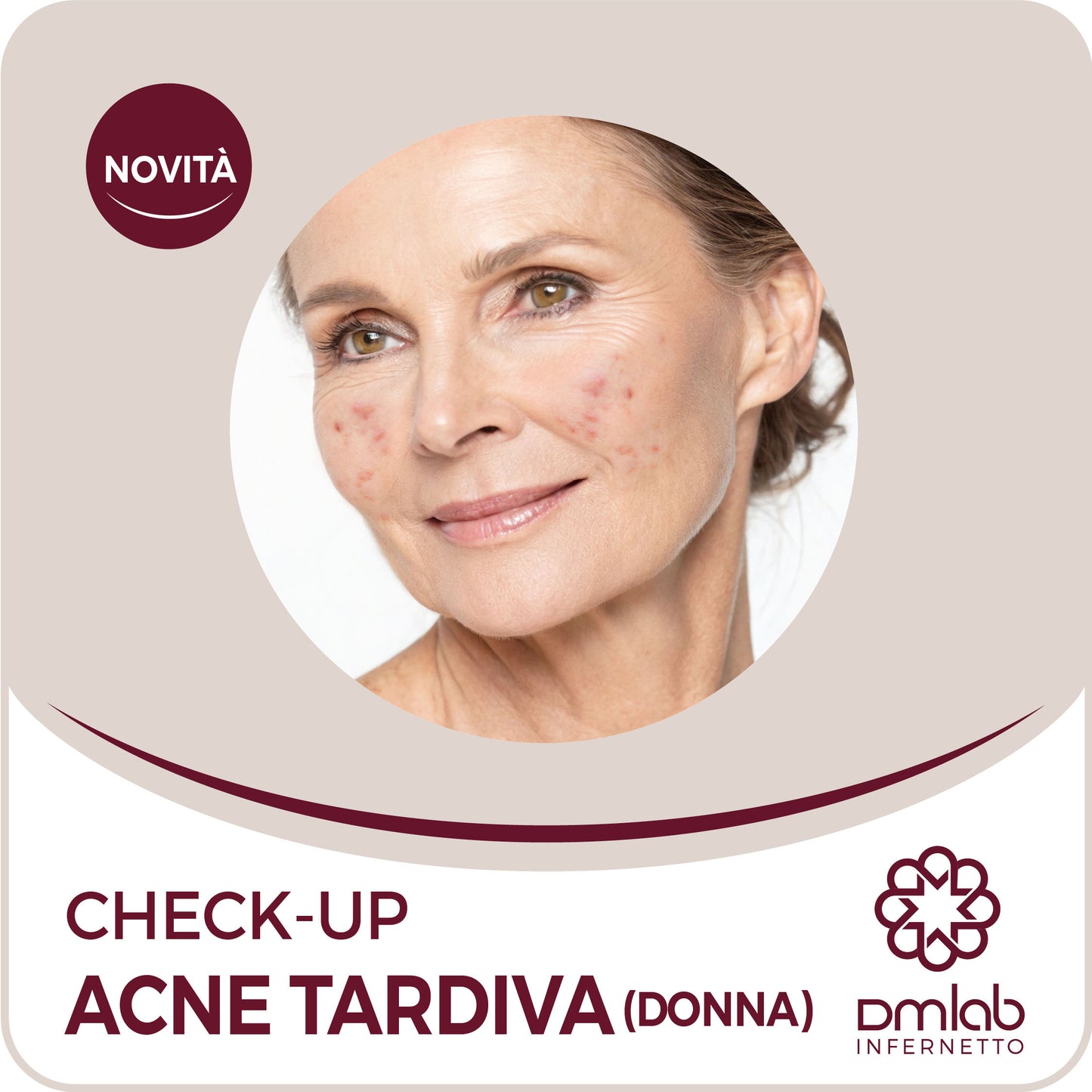 Check-up Acne Tardiva Donna