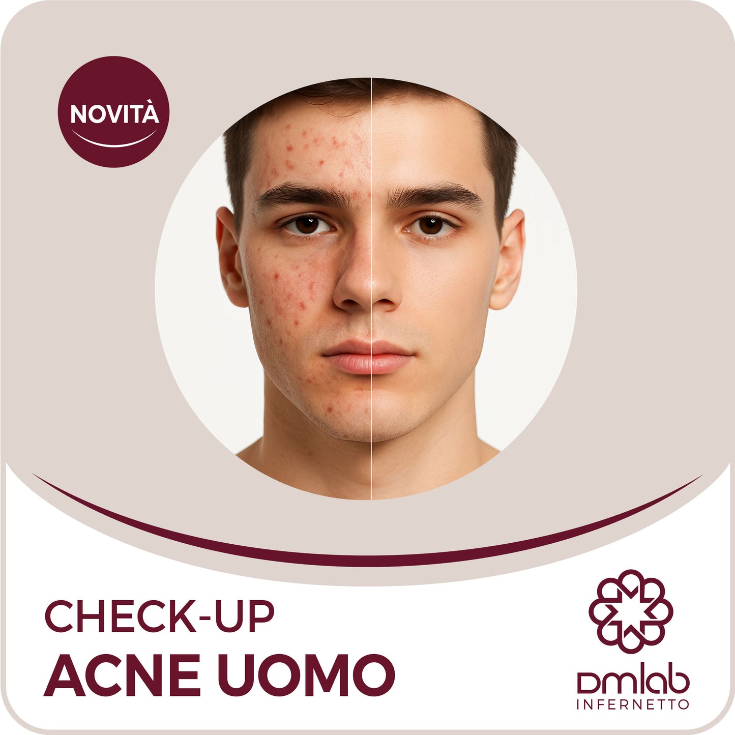 Check-up Acne Uomo