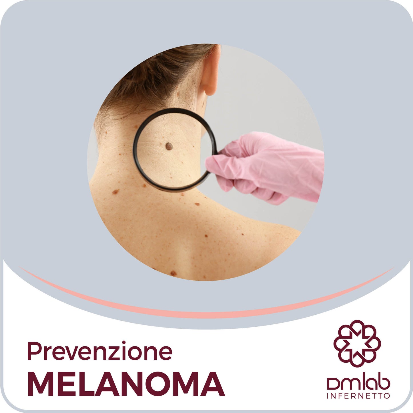 Prevenzione Melanoma