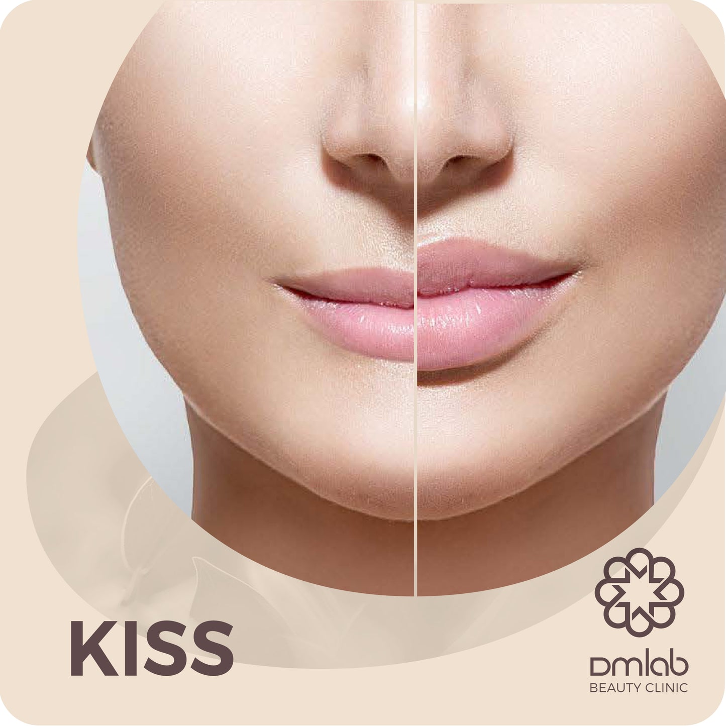 KISS