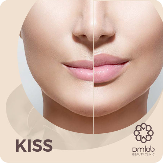 KISS