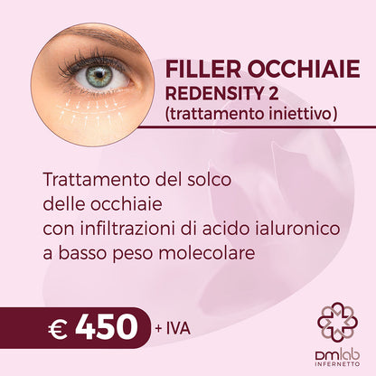 FILLER OCCHIAIE (Trattamento del Solco delle Occhiaie con Infiltrazioni di Acido Ialuronico a Basso Peso Molecolare)