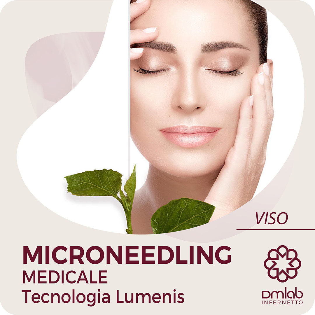 MICRONEEDLING MEDICALE – TECNOLOGIA LUMENIS – VISO