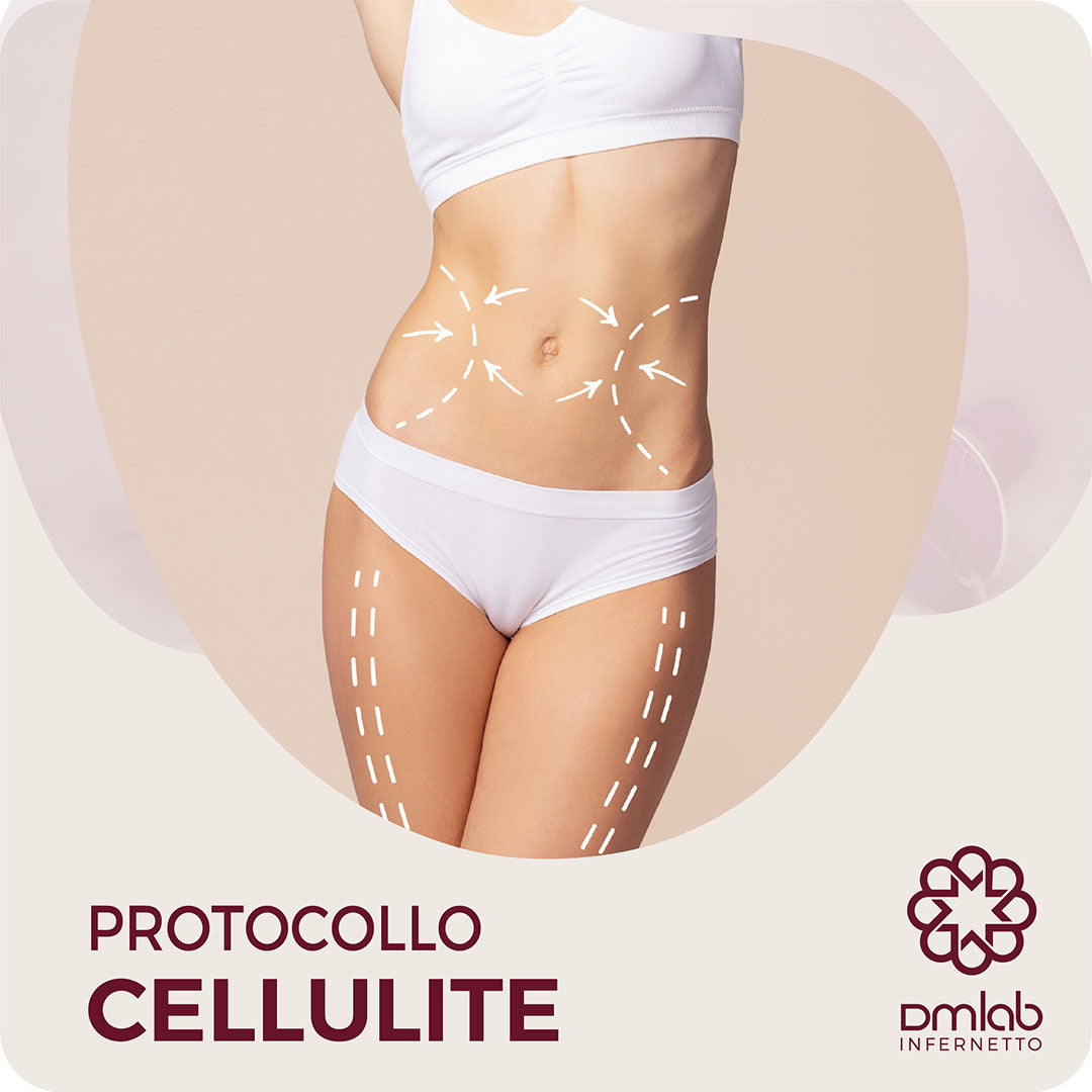 PROTOCOLLO CELLULITE