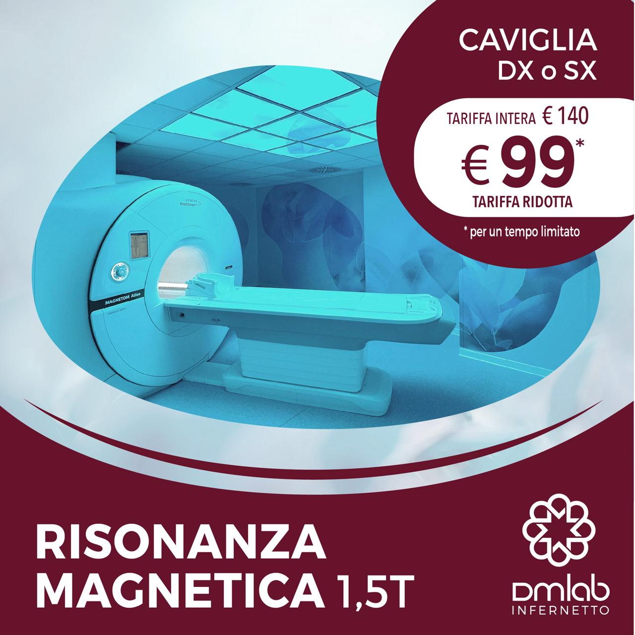 Risonanza Magnetica 1,5T – Caviglia DX o SX