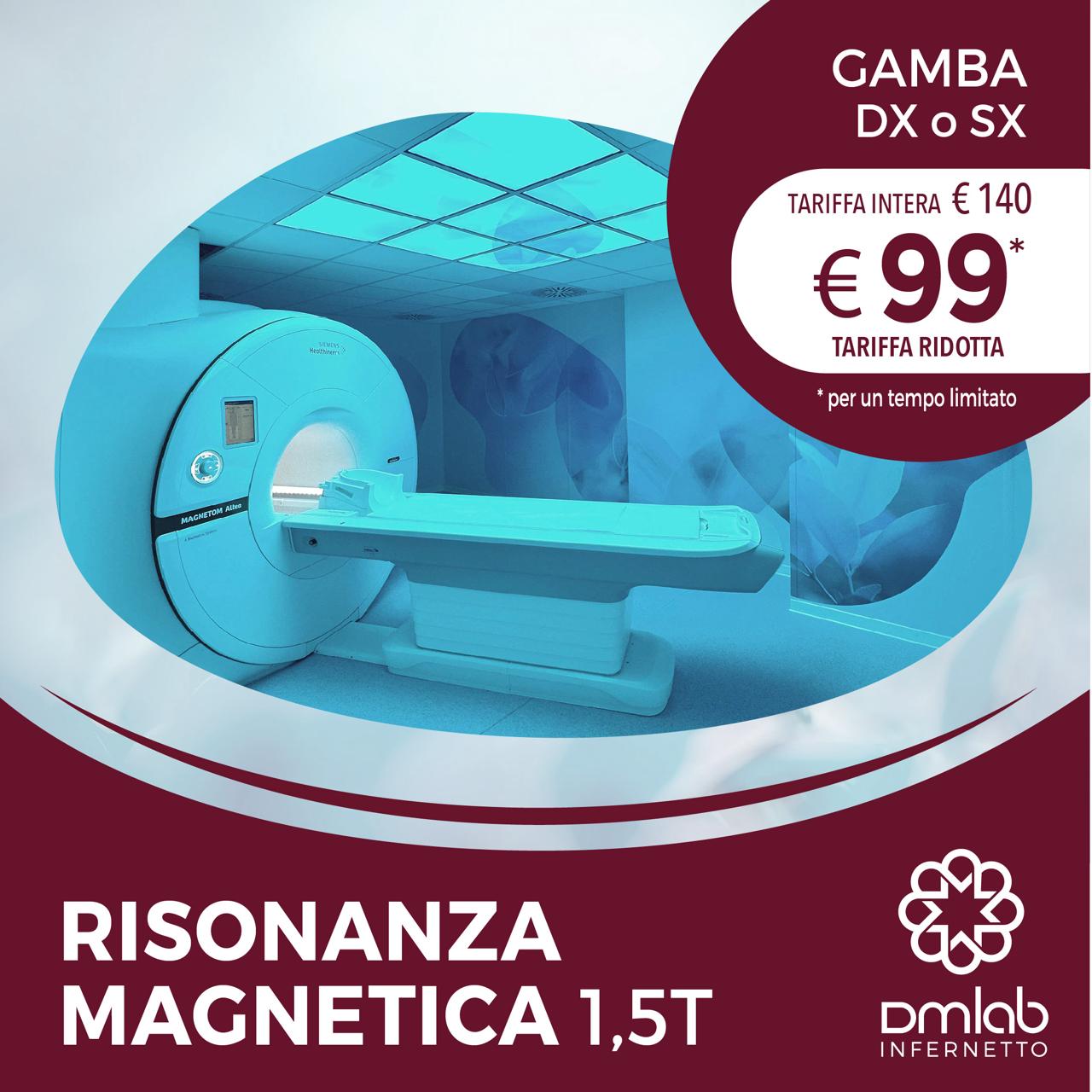 Risonanza Magnetica 1,5T – Gamba DX o SX