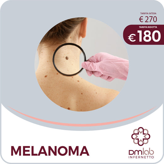 Melanoma